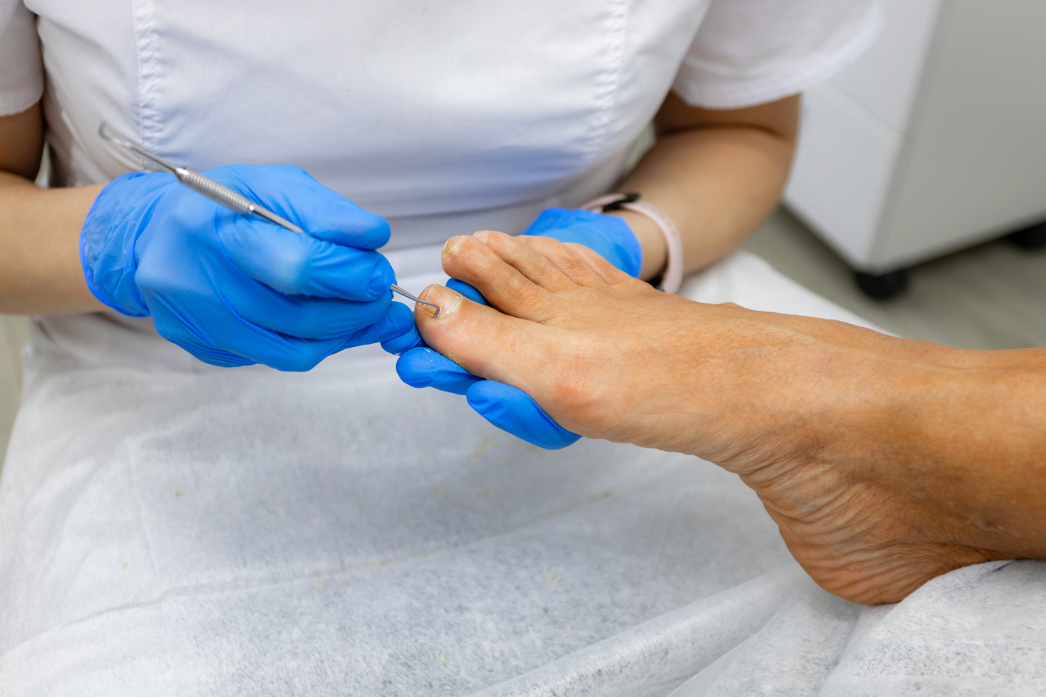 Гигиенический педикюр